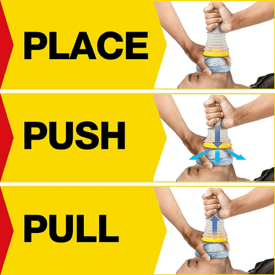 Emergency Anti-Choking Device Wall Mounted Kit